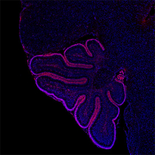 neonatal mouse cerebellum